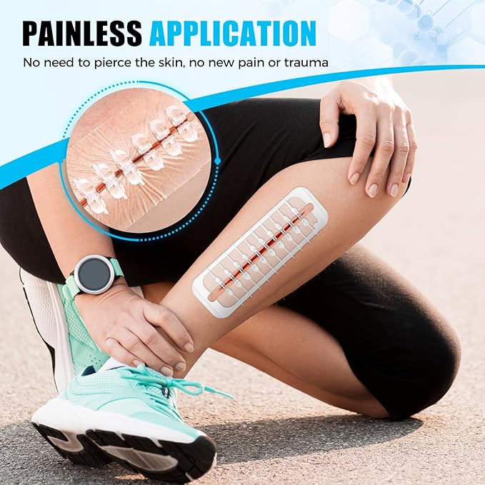 Large Butterfly Bandages for Extra Large Wounds | FSA/HSA Eligible Steri Strips Wound Closure - Surgical-Grade Stitch-Free Laceration Repair & Rapid Hemostasis, Emergency First Aid Care