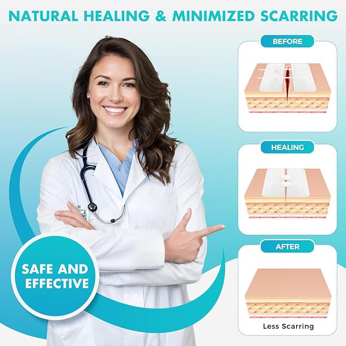 Zip Stitch Wound Closure Strips | 4-Pack Stitchless Butterfly Bandages | Adjustable Tension for Painless Laceration Repair, Post-Surgery Care & Emergency First Aid