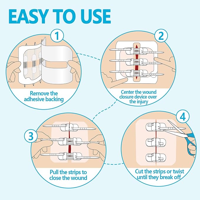 Zip Sutures Butterfly Bandaids – 4-Pack Assorted Sizes, FSA/HSA Eligible Emergency Wound Closure Kit for Surgical Laceration Repair Without Stitches, Fast Hemostasis Adhesive Strips Bandages (PU)