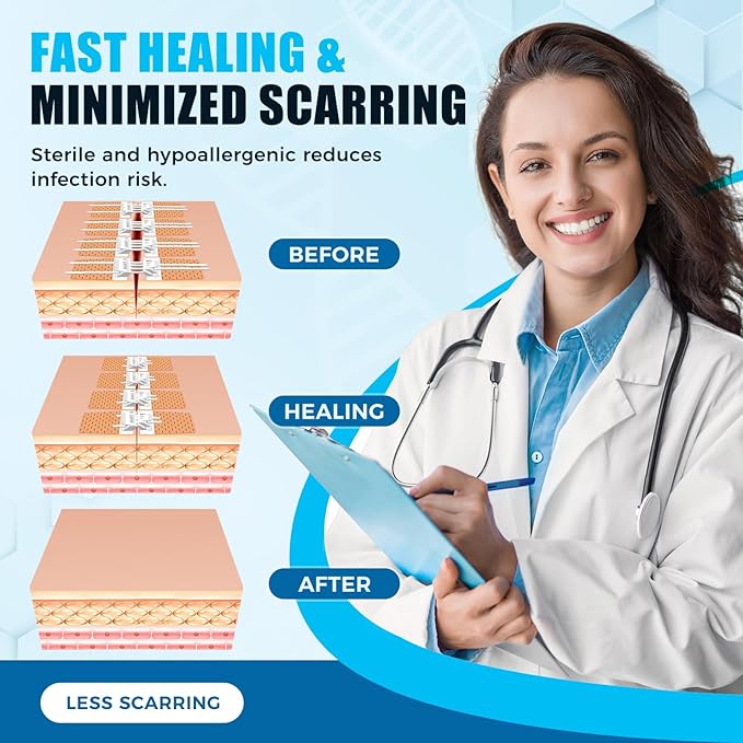 Wound Closure Device 4 Pcs - FSA/HSA Eligible Zip Sutures & Butterfly Bandage | Stitch-Free Wound Repair, Rapid Hemostasis for Hiking, Camping, Wilderness Survival | Outdoor First Aid Essentials