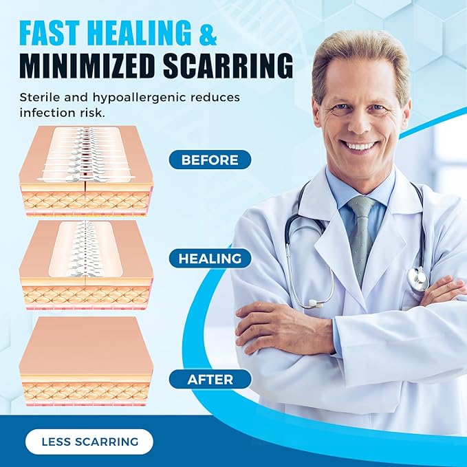 Large Butterfly Bandages for Extra Large Wounds | FSA/HSA Eligible Steri Strips Wound Closure - Surgical-Grade Stitch-Free Laceration Repair & Rapid Hemostasis, Emergency First Aid Care