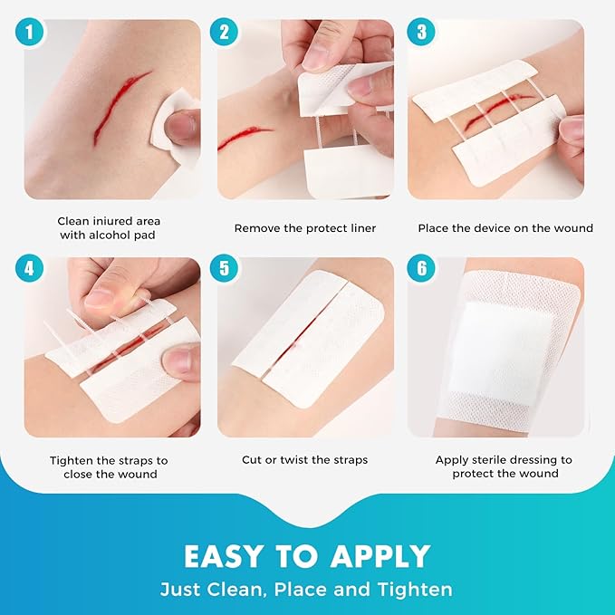 Zip Stitch Wound Closure Strips Extra Large | 2-Pack Stitchless Butterfly Bandages | Adjustable Tension for Painless Laceration Repair, Post-Surgery Care & Emergency First Aid