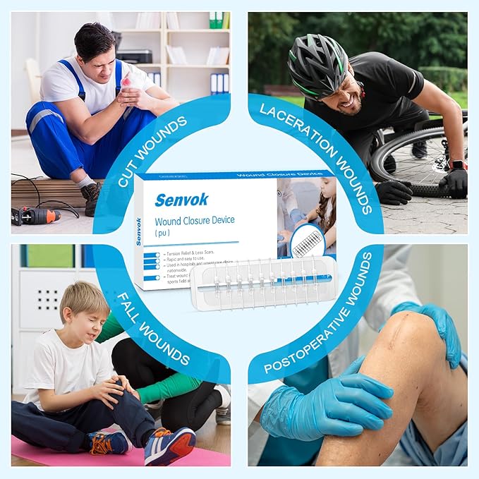 Large Butterfly Bandages for Extra Large Wounds | FSA/HSA Eligible Steri Strips Wound Closure - Surgical-Grade Stitch-Free Laceration Repair & Rapid Hemostasis, Emergency First Aid Care