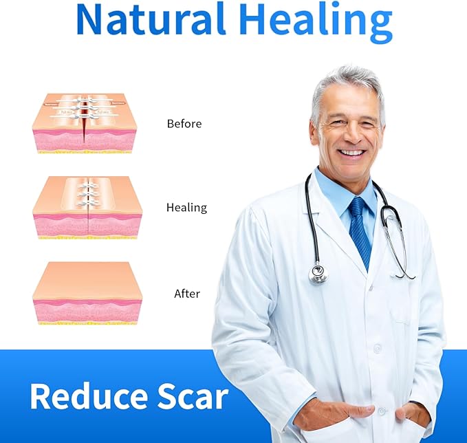 Emergency Laceration Closures Kits - 4 Pcs Repair Wounds Without Stitches Skin Wound Closure Device for First Aid Kit Supplies Zip Sutures for Quick Wound Closures Adhesive Bandages Kit