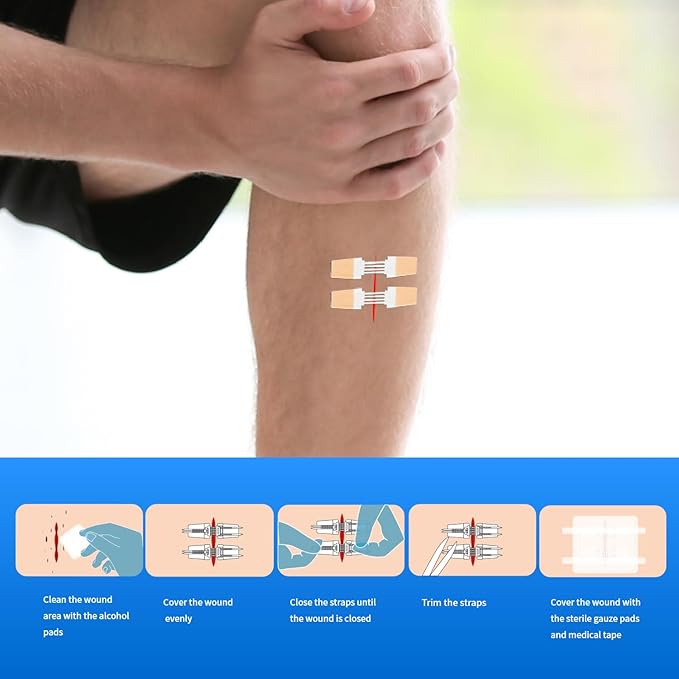 Emergency Laceration Closures Kits - 4 Pcs Repair Wounds Without Stitches Skin Wound Closure Device for First Aid Kit Supplies Zip Sutures for Quick Wound Closures Adhesive Bandages Kit