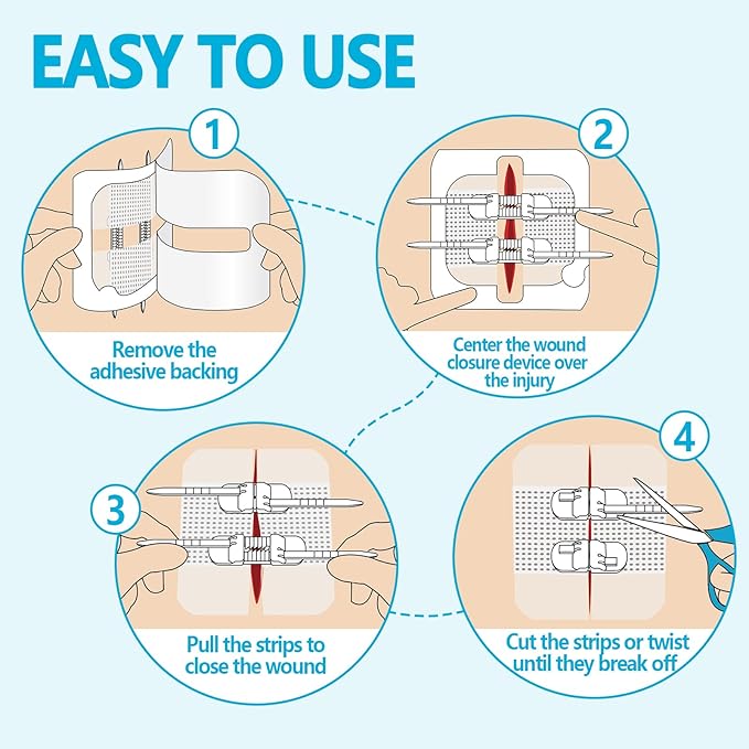 Senvok Emergency Wound Closure Device 4 Pcs - Upgraded Zip Stitch Wound Closure Strips - Butterfly Bandages Laceration Closure Strips for Quick, Painless, Stitchless Wound Closure