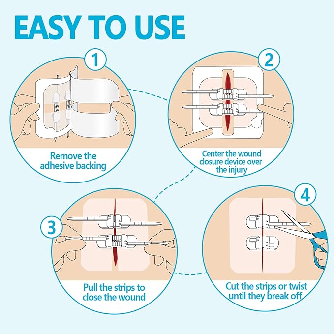 Sutures Butterfly Bandaids - 4 Pcs Laceration Kit - FSA HSA Eligible Surgical Laceration Repair Without Sew - Quick Clot -Emergency Wound Closures Device (PU)