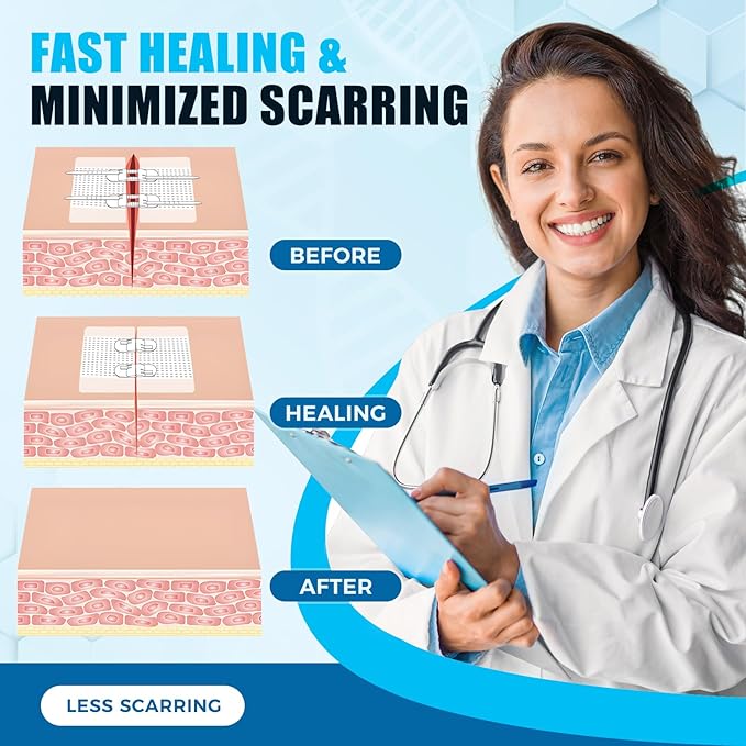 Senvok Emergency Wound Closure Device 4 Pcs - Upgraded Zip Stitch Wound Closure Strips - Butterfly Bandages Laceration Closure Strips for Quick, Painless, Stitchless Wound Closure