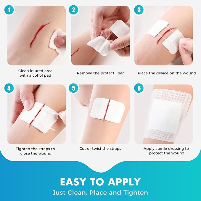 Zip Stitch Wound Closure Strips | 2-Pack Stitchless Butterfly Bandages | Adjustable Tension for Painless Laceration Repair, Post-Surgery Care & Emergency First Aid