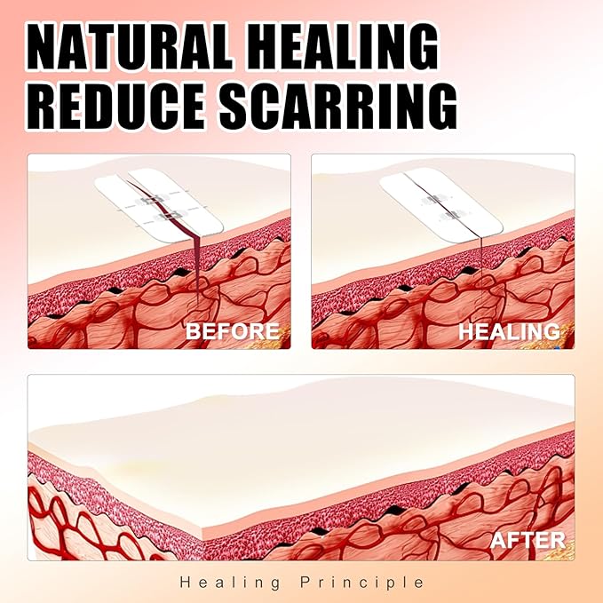 Carbou Emergency Wound Closure Strips - 2 Pcs - Zip Stitch Butterfly Bandaids - Laceration Closure Kit - Stitchless & Easy to Use