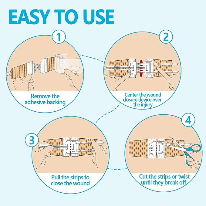 Wound Closure Device 4 Pcs - FSA/HSA Eligible Zip Sutures & Butterfly Bandage | Stitch-Free Wound Repair, Rapid Hemostasis for Hiking, Camping, Wilderness Survival | Outdoor First Aid Essentials